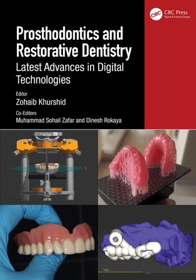 Zohaib Khurshid, Muhammad Sohail Zafar, Dinesh Rokaya - Prosthodontics and Restorative Dentistry, Inbunden