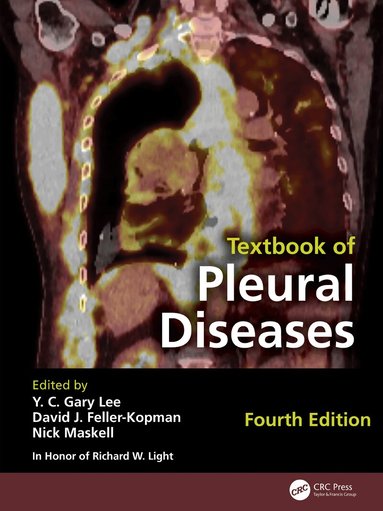 Y C Gary Lee, David J. Feller- Kopman, Nick Maskell, Richard W. Light - Textbook of Pleural Diseases, Inbunden