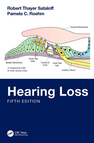 Robert Thayer Sataloff, Pamela C. Roehm - Hearing Loss, Inbunden
