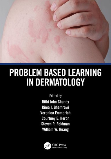 Rithi John Chandy, Rima I. Ghamrawi, Veronica Emmerich, Courtney E. Heron, Steven R. Feldman, William W. Huang - Problem Based Learning in Dermatology, Häftad