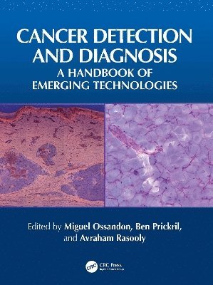 bokomslag Cancer Detection and Diagnosis