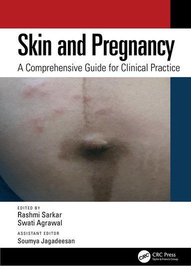 Rashmi Sarkar, Swati Agrawal, Soumya Jagadeesan - Skin and Pregnancy, Häftad