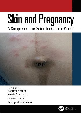 bokomslag Skin and Pregnancy