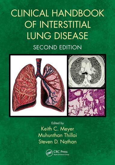 Keith C. Meyer, Muhunthan Thillai, Steven D. Nathan - Clinical Handbook of Interstitial Lung Disease, Inbunden