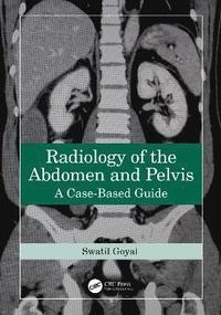bokomslag Radiology of the Abdomen and Pelvis