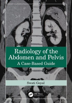 bokomslag Radiology of the Abdomen and Pelvis