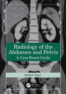 Radiology of the Abdomen and Pelvis 1