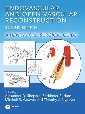 bokomslag Endovascular and Open Vascular Reconstruction