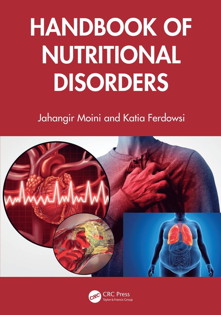 Handbook of Nutritional Disorders 1