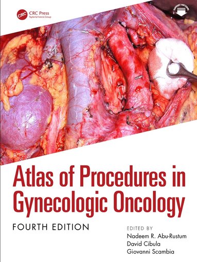 Nadeem R. Abu-Rustum, David Cibula, Giovanni Scambia - Atlas of Procedures in Gynecologic Oncology, Inbunden