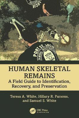 Human Skeletal Remains 1