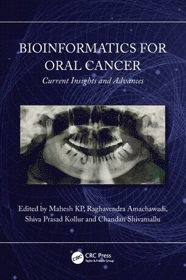 Mahesh KP, Raghavendra Amachawadi, Shiva Prasad Kollur, Chandan Shivamallu - Bioinformatics for Oral Cancer, Häftad