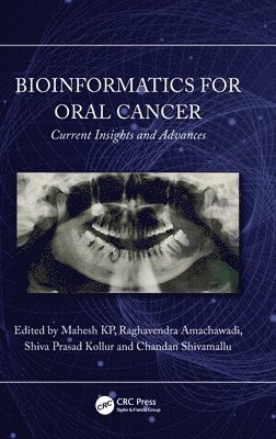 Bioinformatics for Oral Cancer 1