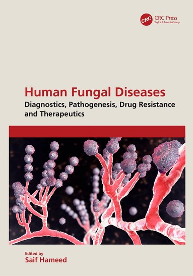 Saif Hameed - Human Fungal Diseases, Inbunden