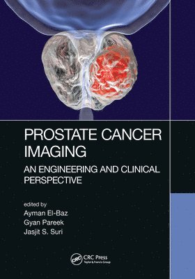 bokomslag Prostate Cancer Imaging