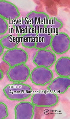 bokomslag Level Set Method in Medical Imaging Segmentation