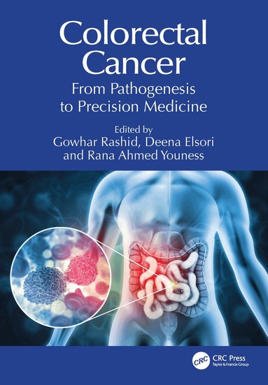 Gowhar Rashid, Deena Elsori, Rana Ahmed Youness - Colorectal Cancer, Häftad