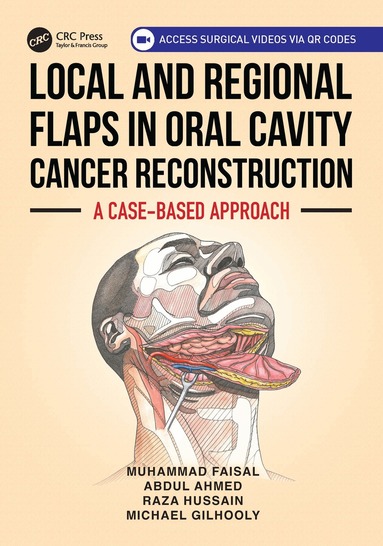 Muhammad Faisal, Abdul Ahmed, Raza Hussain, Michael Gilhooly - Local and Regional Flaps in Oral Cavity Cancer Reconstruction, Häftad