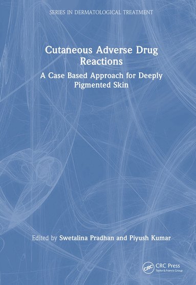 Swetalina Pradhan, Piyush Kumar - Cutaneous Adverse Drug Reactions, Inbunden