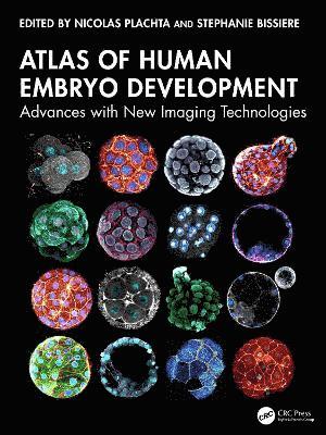 bokomslag Atlas of Human Embryo Development