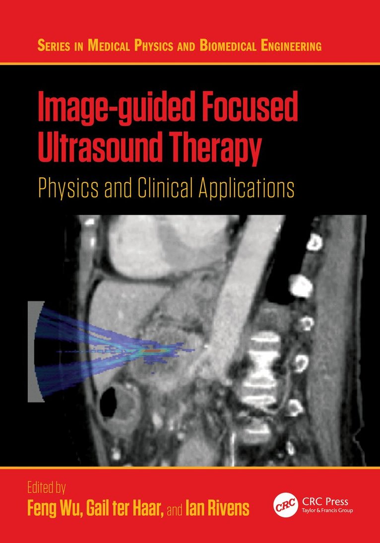 Feng Wu, Gail ter Haar, Ian Rivens - Image-guided Focused Ultrasound Therapy, Häftad