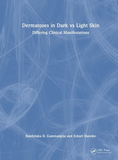 bokomslag Dermatoses in Dark Vs Light Skin