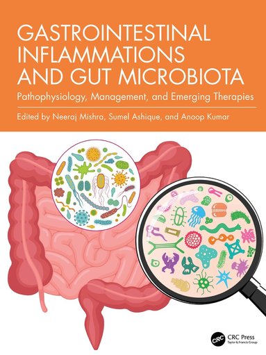 Neeraj Mishra, Sumel Ashique, Anoop Kumar - Gastrointestinal Inflammations and Gut Microbiota, Inbunden