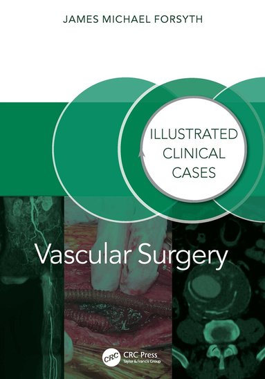 James Forsyth - Vascular Surgery:, Häftad