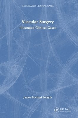 Vascular Surgery: 1