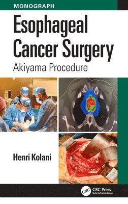 bokomslag Esophageal Cancer Surgery