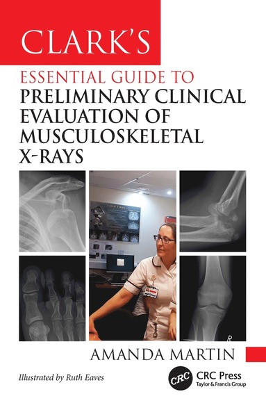 bokomslag Clark's Essential Guide to Preliminary Clinical Evaluation of Musculoskeletal X-rays
