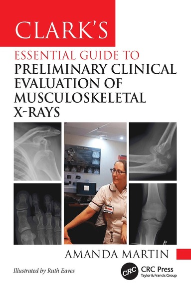 bokomslag Clarks Essential Guide to Preliminary Clinical Evaluation of Musculoskeletal X-rays