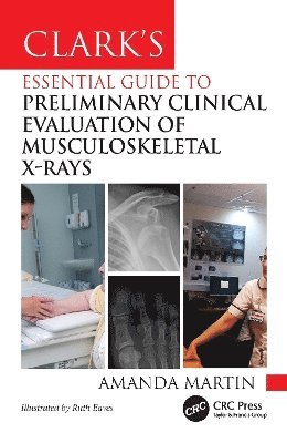 Amanda Martin - Clark’s Essential Guide to Preliminary Clinical Evaluation of Musculoskeletal X-rays, Häftad