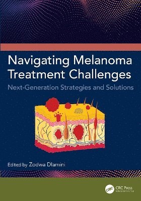 Navigating Melanoma Treatment Challenges 1