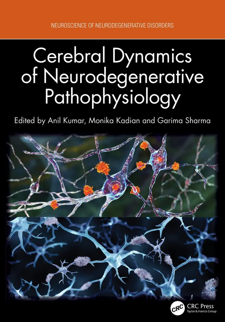 Anil Kumar, Monika Kadian, Garima Sharma - Cerebral Dynamics of Neurodegenerative Pathophysiology, Inbunden. Tillgänglighet: Kommande