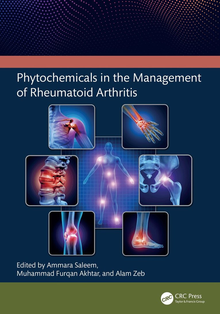 Ammara Saleem, Muhammad Furqan Akhtar, Alam Zeb - Phytochemicals in the Management of Rheumatoid Arthritis, Inbunden. Tillgänglighet: Lägg i varukorg