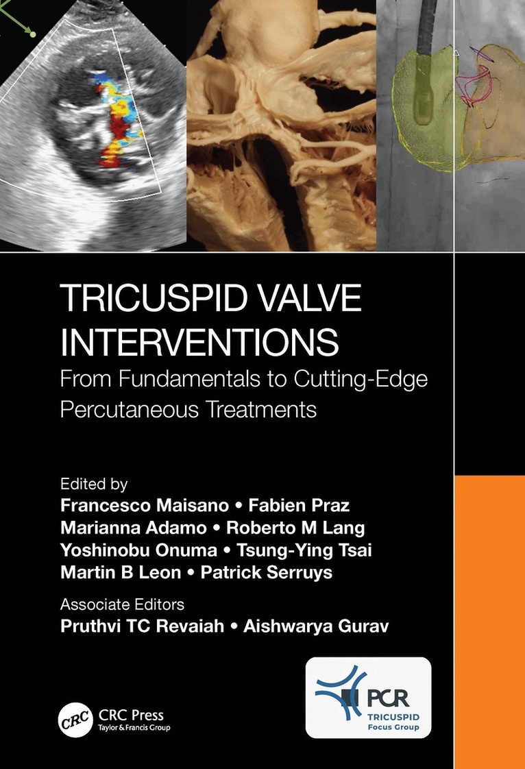 Francesco Maisano, Fabien Praz, Marianna Adamo, Roberto M Lang, Yoshinobu Onuma, Tsung-Ying Tsai, Martin B Leon, Patrick Serruys - Tricuspid Valve Interventions, Inbunden
