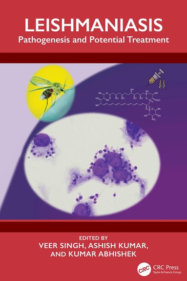 Veer Singh, Ashish Kumar, Kumar Abhishek - Leishmaniasis, Inbunden