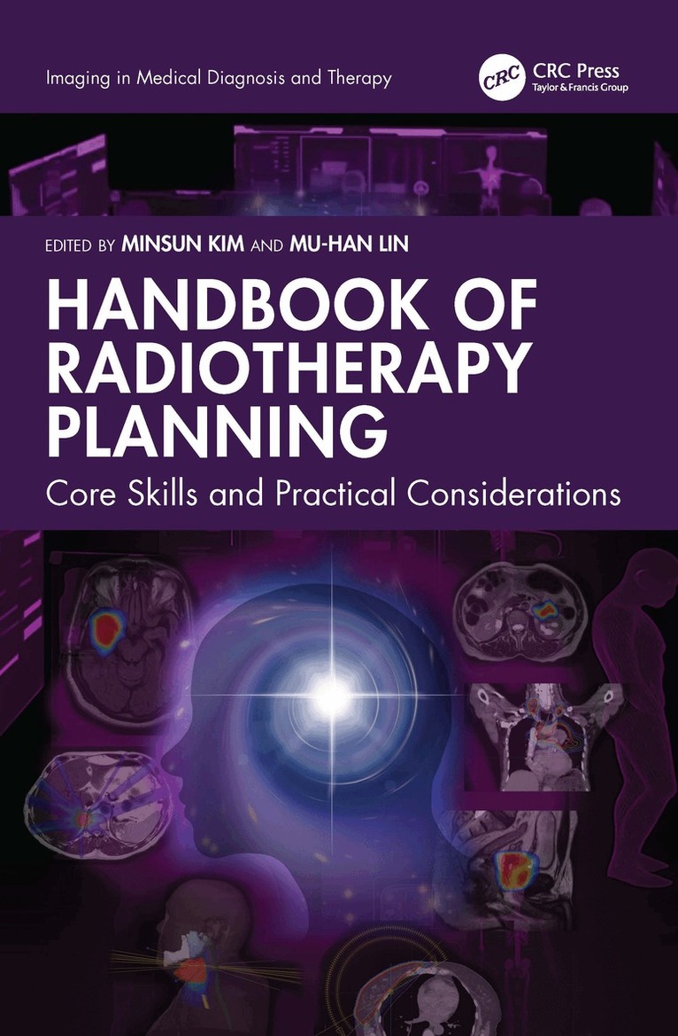 Handbook of Radiotherapy Planning