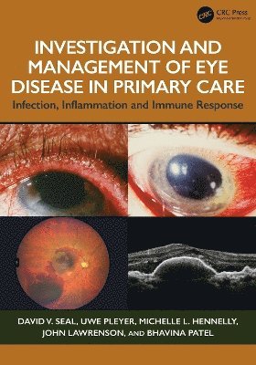 David V. Seal, Uwe Pleyer, Michelle L Hennelly, John Lawrenson, Bhavina Patel, UK) Seal, David V. (London, David V. Seal, Uwe Pleyer - Investigation & Management of Eye Disease in Primary Care, Häftad