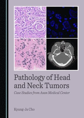 bokomslag Pathology of Head and Neck Tumors