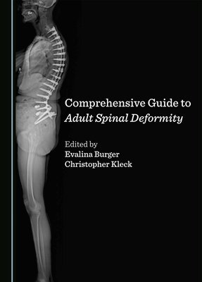 bokomslag Comprehensive Guide to Adult Spinal Deformity