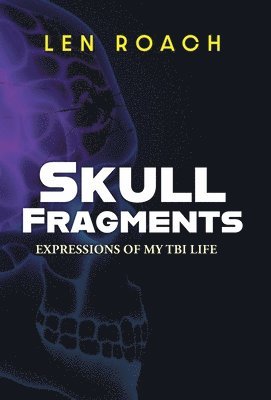 Skull Fragments 1