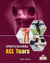 bokomslag ACL Tears