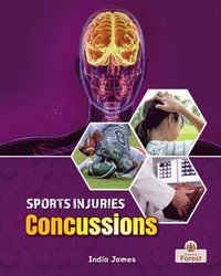 bokomslag Concussions