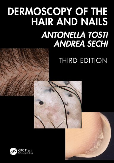 Antonella Tosti, Andrea Sechi - Dermoscopy of the Hair and Nails 3e, Inbunden