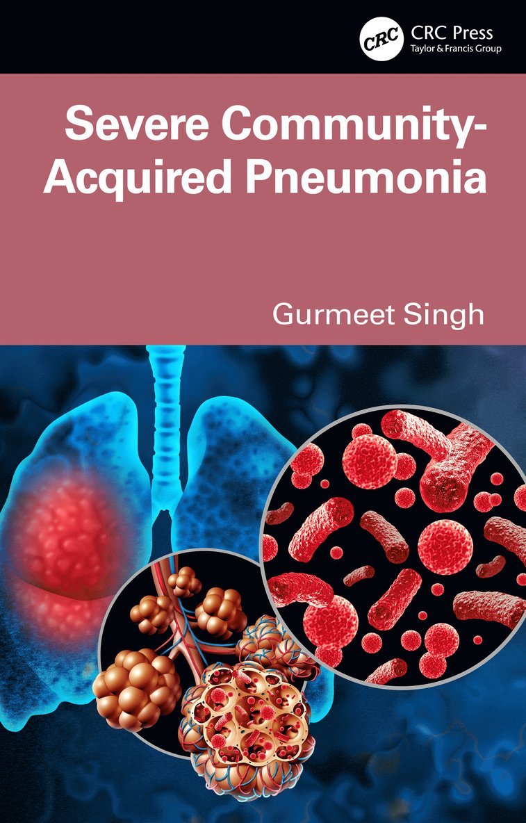 Gurmeet Singh - Severe Community-Acquired Pneumonia, Häftad