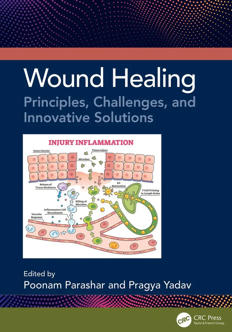 Poonam Parashar, Pragya Yadav - Wound Healing, Inbunden. Tillgänglighet: Kommande