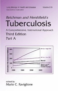 bokomslag Reichman and Hershfield's Tuberculosis