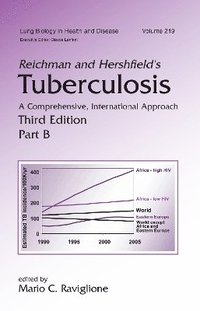 bokomslag Reichman & Hershfield's Tuberculosis